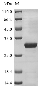 (Tris-Glycine gel) Discontinuous SDS-PAGE (reduced) with 5% enrichment gel and 15% separation gel. (Tris-Glycine gel) Discontinuous SDS-PAGE (reduced) with 5% enrichment gel and 15% separation gel.