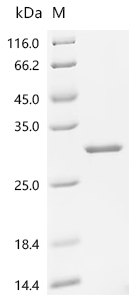 (Tris-Glycine gel) Discontinuous SDS-PAGE (reduced) with 5% enrichment gel and 15% separation gel.