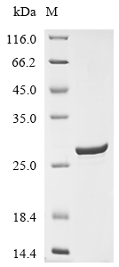 (Tris-Glycine gel) Discontinuous SDS-PAGE (reduced) with 5% enrichment gel and 15% separation gel. (Tris-Glycine gel) Discontinuous SDS-PAGE (reduced) with 5% enrichment gel and 15% separation gel.