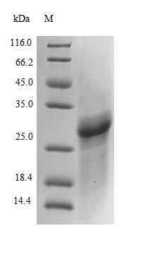 (Tris-Glycine gel) Discontinuous SDS-PAGE (reduced) with 5% enrichment gel and 15% separation gel. (Tris-Glycine gel) Discontinuous SDS-PAGE (reduced) with 5% enrichment gel and 15% separation gel.