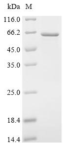 Recombinant Human Coronin-1A (CORO1A) - image 1