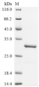 (Tris-Glycine gel) Discontinuous SDS-PAGE (reduced) with 5% enrichment gel and 15% separation gel. (Tris-Glycine gel) Discontinuous SDS-PAGE (reduced) with 5% enrichment gel and 15% separation gel.