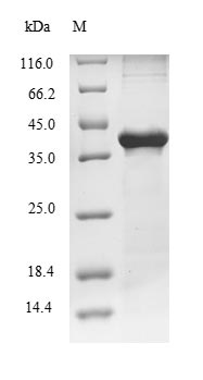 (Tris-Glycine gel) Discontinuous SDS-PAGE (reduced) with 5% enrichment gel and 15% separation gel.