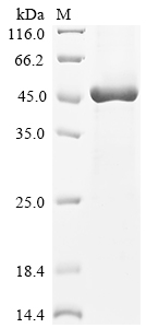 (Tris-Glycine gel) Discontinuous SDS-PAGE (reduced) with 5% enrichment gel and 15% separation gel. (Tris-Glycine gel) Discontinuous SDS-PAGE (reduced) with 5% enrichment gel and 15% separation gel.