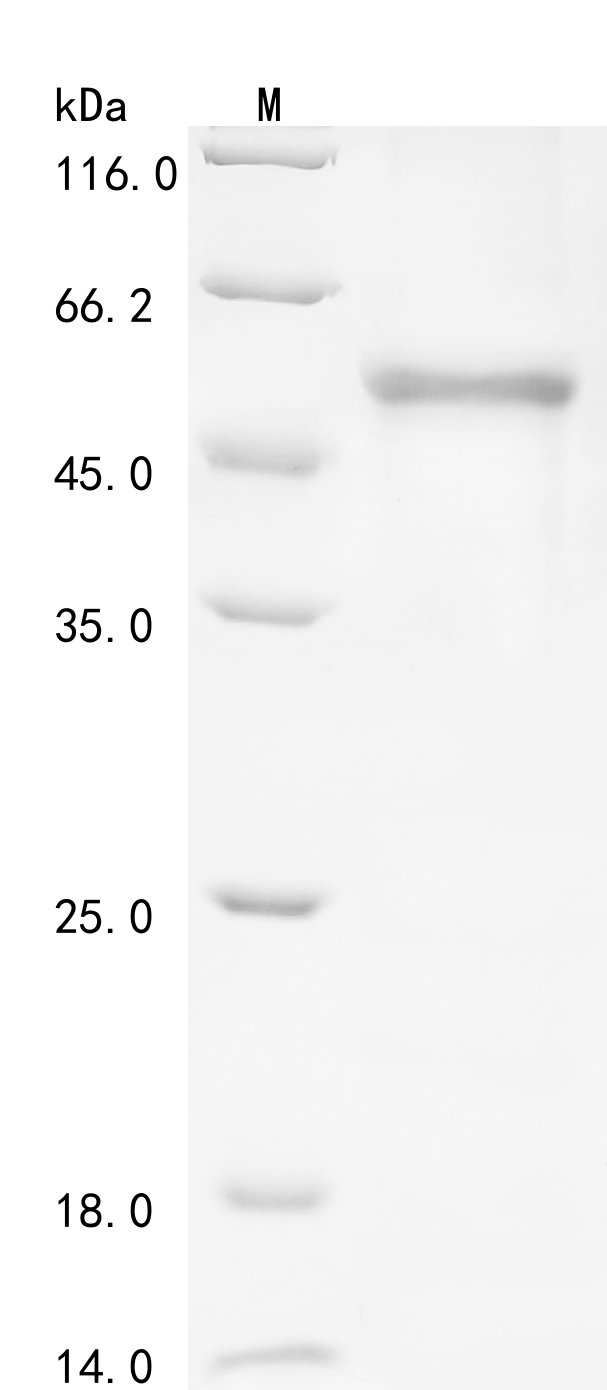 Recombinant Human Carboxypeptidase N subunit 2 (CPN2) - image 1
