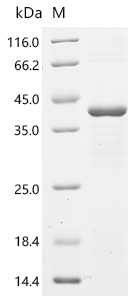 (Tris-Glycine gel) Discontinuous SDS-PAGE (reduced) with 5% enrichment gel and 15% separation gel.