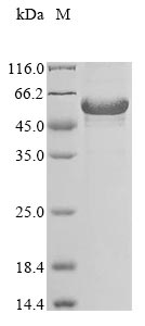 Recombinant Human Cytokine receptor-like factor 3 (CRLF3) - image 1