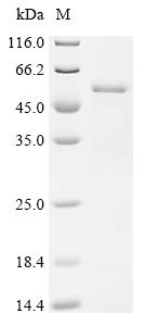 (Tris-Glycine gel) Discontinuous SDS-PAGE (reduced) with 5% enrichment gel and 15% separation gel.