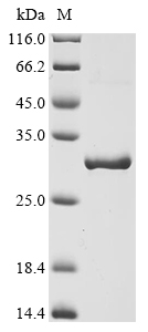 Recombinant Bovine Alpha-crystallin B chain (CRYAB) - image 1