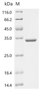 Recombinant Rabbit Beta-crystallin B2 (CRYBB2) - image 1