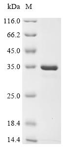 Recombinant Human Beta-crystallin B3 (CRYBB3) - image 1