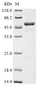 (Tris-Glycine gel) Discontinuous SDS-PAGE (reduced) with 5% enrichment gel and 15% separation gel.