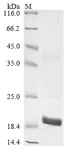Recombinant Mouse Granulocyte-macrophage colony-stimulating factor (Csf2) - image 1