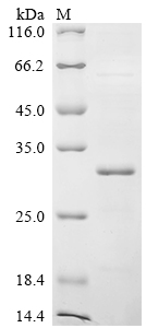 (Tris-Glycine gel) Discontinuous SDS-PAGE (reduced) with 5% enrichment gel and 15% separation gel.