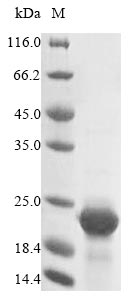 (Tris-Glycine gel) Discontinuous SDS-PAGE (reduced) with 5% enrichment gel and 15% separation gel. (Tris-Glycine gel) Discontinuous SDS-PAGE (reduced) with 5% enrichment gel and 15% separation gel.
