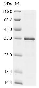 Recombinant Human Cancer/testis antigen 2 (CTAG2) - image 1