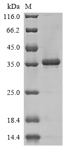 (Tris-Glycine gel) Discontinuous SDS-PAGE (reduced) with 5% enrichment gel and 15% separation gel. (Tris-Glycine gel) Discontinuous SDS-PAGE (reduced) with 5% enrichment gel and 15% separation gel.