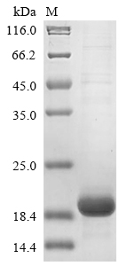 (Tris-Glycine gel) Discontinuous SDS-PAGE (reduced) with 5% enrichment gel and 15% separation gel. (Tris-Glycine gel) Discontinuous SDS-PAGE (reduced) with 5% enrichment gel and 15% separation gel.