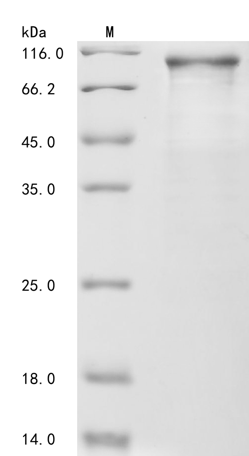 (Tris-Glycine gel) Discontinuous SDS-PAGE (reduced) with 5% enrichment gel and 15% separation gel. (Tris-Glycine gel) Discontinuous SDS-PAGE (reduced) with 5% enrichment gel and 15% separation gel.
