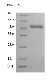 (Tris-Glycine gel) Discontinuous SDS-PAGE (reduced) with 5% enrichment gel and 15% separation gel.