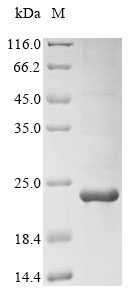 Recombinant Mouse C-X-C chemokine receptor type 3 (Cxcr3) , partial - image 1