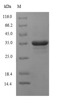 (Tris-Glycine gel) Discontinuous SDS-PAGE (reduced) with 5% enrichment gel and 15% separation gel.