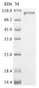 (Tris-Glycine gel) Discontinuous SDS-PAGE (reduced) with 5% enrichment gel and 15% separation gel. (Tris-Glycine gel) Discontinuous SDS-PAGE (reduced) with 5% enrichment gel and 15% separation gel.