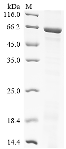 (Tris-Glycine gel) Discontinuous SDS-PAGE (reduced) with 5% enrichment gel and 15% separation gel. (Tris-Glycine gel) Discontinuous SDS-PAGE (reduced) with 5% enrichment gel and 15% separation gel.
