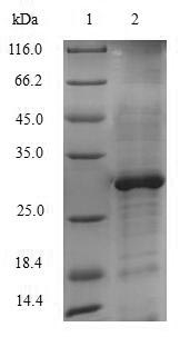(Tris-Glycine gel) Discontinuous SDS-PAGE (reduced) with 5% enrichment gel and 15% separation gel.