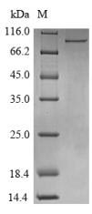 CSB-EP006621HU SDS-PAGE