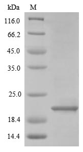 (Tris-Glycine gel) Discontinuous SDS-PAGE (reduced) with 5% enrichment gel and 15% separation gel. (Tris-Glycine gel) Discontinuous SDS-PAGE (reduced) with 5% enrichment gel and 15% separation gel.