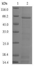 (Tris-Glycine gel) Discontinuous SDS-PAGE (reduced) with 5% enrichment gel and 15% separation gel. (Tris-Glycine gel) Discontinuous SDS-PAGE (reduced) with 5% enrichment gel and 15% separation gel.
