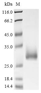 (Tris-Glycine gel) Discontinuous SDS-PAGE (reduced) with 5% enrichment gel and 15% separation gel.