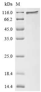 Recombinant Human Disks large homolog 4 (DLG4) - image 1