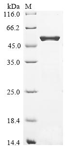 (Tris-Glycine gel) Discontinuous SDS-PAGE (reduced) with 5% enrichment gel and 15% separation gel.