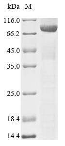 SDS-PAGE- Recombinant protein Human DNM1L