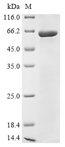 (Tris-Glycine gel) Discontinuous SDS-PAGE (reduced) with 5% enrichment gel and 15% separation gel. (Tris-Glycine gel) Discontinuous SDS-PAGE (reduced) with 5% enrichment gel and 15% separation gel.