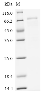 Recombinant Human Desmoglein-3 (DSG3) , partial, Biotinylated - image 1