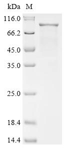 Recombinant Human Segment polarity protein dishevelled homolog DVL-1 (DVL1) - image 1