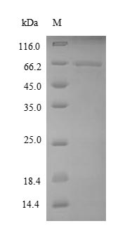 (Tris-Glycine gel) Discontinuous SDS-PAGE (reduced) with 5% enrichment gel and 15% separation gel. (Tris-Glycine gel) Discontinuous SDS-PAGE (reduced) with 5% enrichment gel and 15% separation gel.