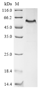 Recombinant Mouse EGF-containing fibulin-like extracellular matrix protein 1 (Efemp1) - image 1