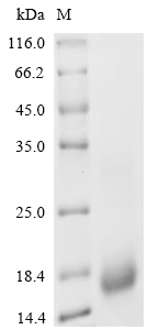 Recombinant Chicken Pro-epidermal growth factor (EGF) , Partial - image 1