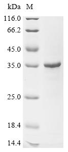 Recombinant Human Egl nine homolog 2 (EGLN2) , Partial - image 1