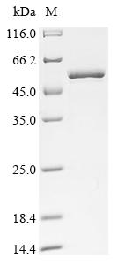 (Tris-Glycine gel) Discontinuous SDS-PAGE (reduced) with 5% enrichment gel and 15% separation gel. (Tris-Glycine gel) Discontinuous SDS-PAGE (reduced) with 5% enrichment gel and 15% separation gel.