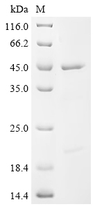 Recombinant Human Eukaryotic initiation factor 4A-I (EIF4A1) - image 1