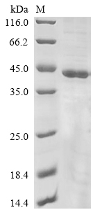 (Tris-Glycine gel) Discontinuous SDS-PAGE (reduced) with 5% enrichment gel and 15% separation gel.