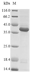 CSB-EP007722HU1