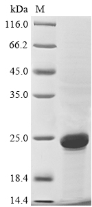 (Tris-Glycine gel) Discontinuous SDS-PAGE (reduced) with 5% enrichment gel and 15% separation gel. (Tris-Glycine gel) Discontinuous SDS-PAGE (reduced) with 5% enrichment gel and 15% separation gel.