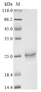 Recombinant Human Epidermal growth factor receptor substrate 15 (EPS15) , partial - image 1