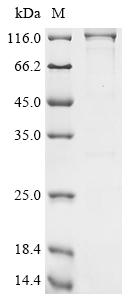 (Tris-Glycine gel) Discontinuous SDS-PAGE (reduced) with 5% enrichment gel and 15% separation gel. (Tris-Glycine gel) Discontinuous SDS-PAGE (reduced) with 5% enrichment gel and 15% separation gel.